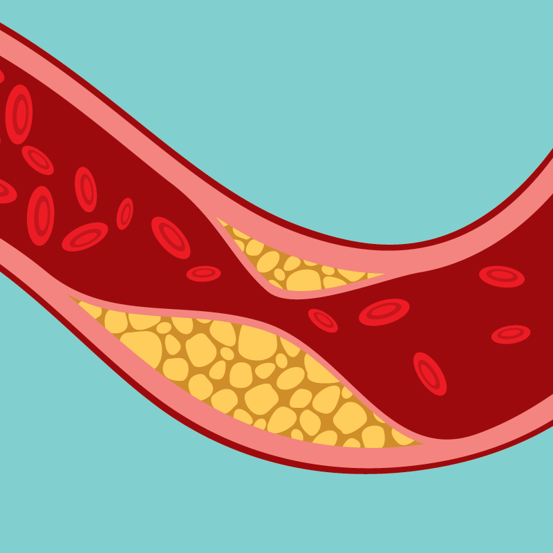 high-cholesterol